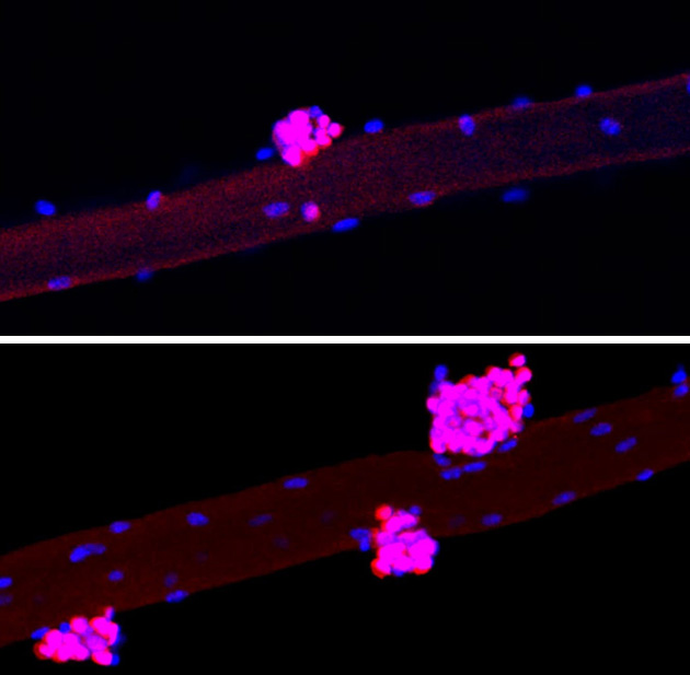 Investigación Izpisúa regeneración muscular