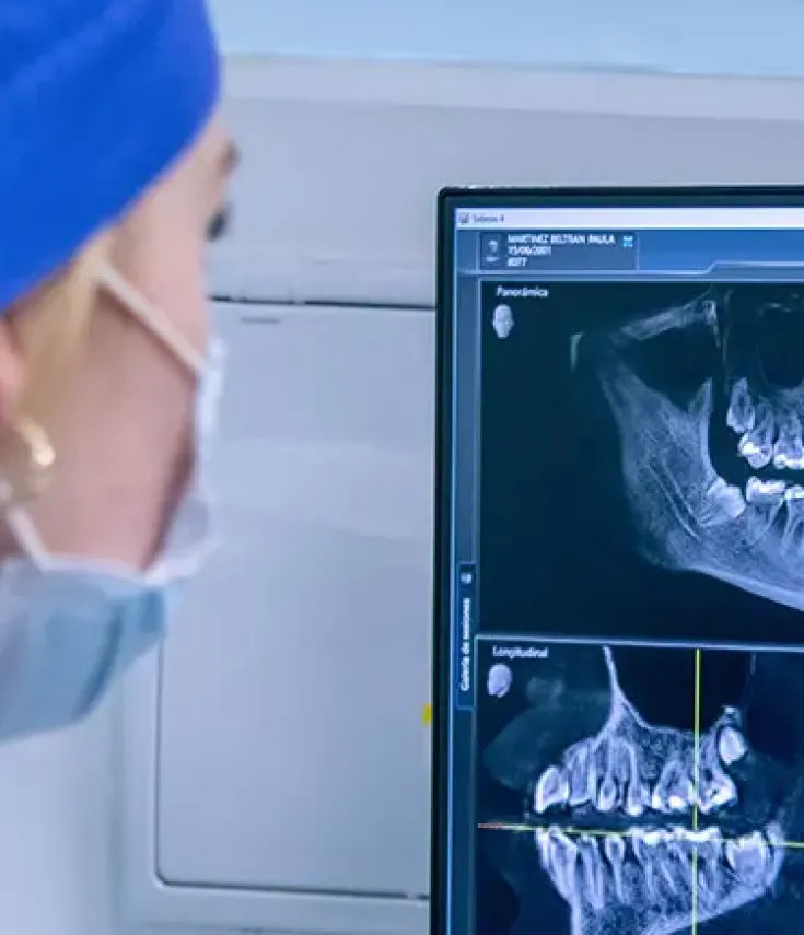 Estudiante del grado en odontología examinando una radiografía bucal de un paciente de la clínica universitaria UCAM Dental.