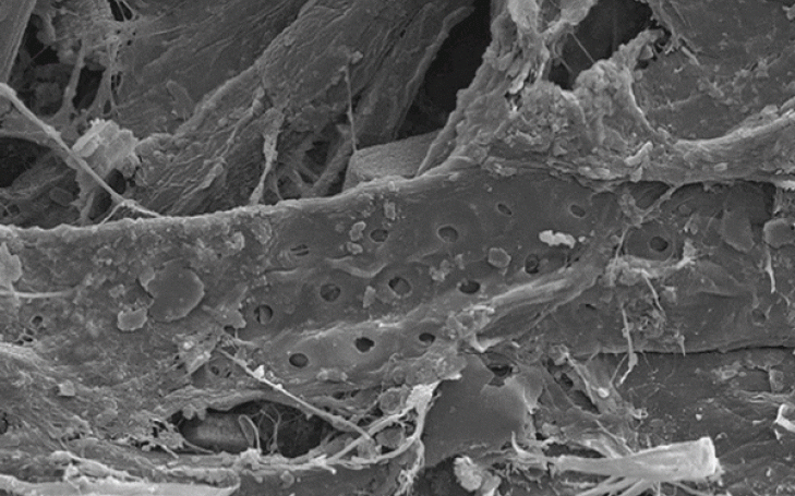 El microscopio electrónico permite avanzar en áreas como la criminología, la alimentación o la ingeniería