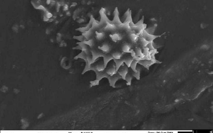 Investigadores de la UCAM hallan evidencias científicas que sitúan al Sudario de Oviedo y la Sábana Santa en el mismo escenario