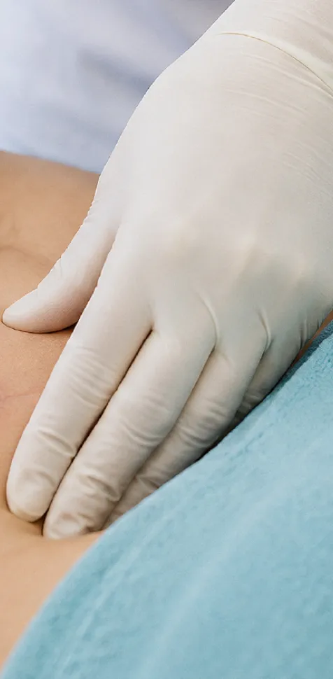 Fisioterapeuta realizando tratamiento manual de una cicatriz abdominal en Fisioterapia Dermatofuncional en la UCAM