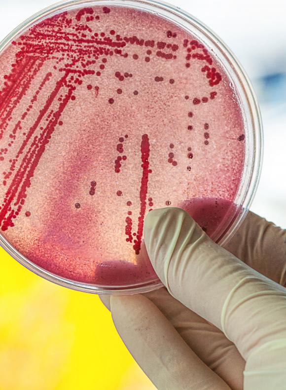 analisis de probeta en laboratorio