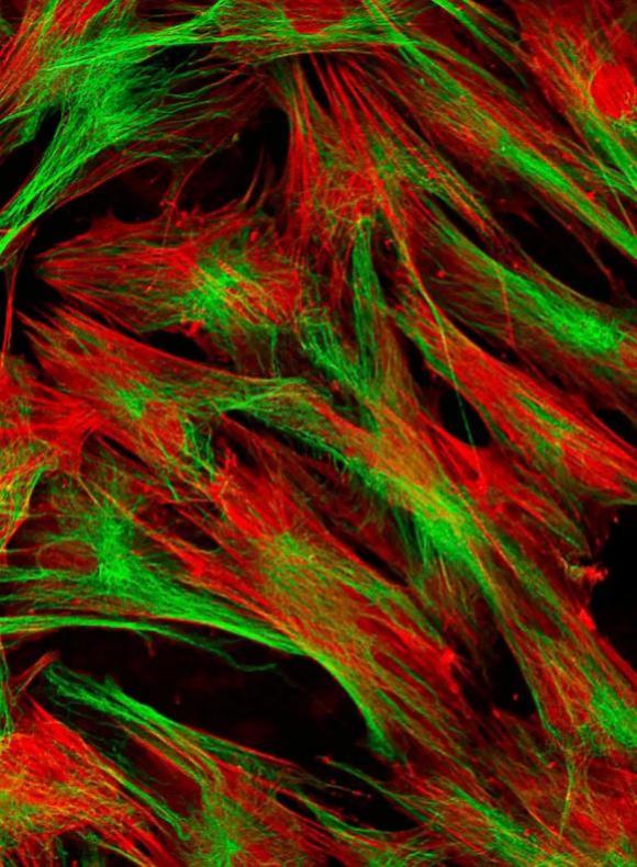 Diploma de Experto en Cultivos Celulares - semipresencial