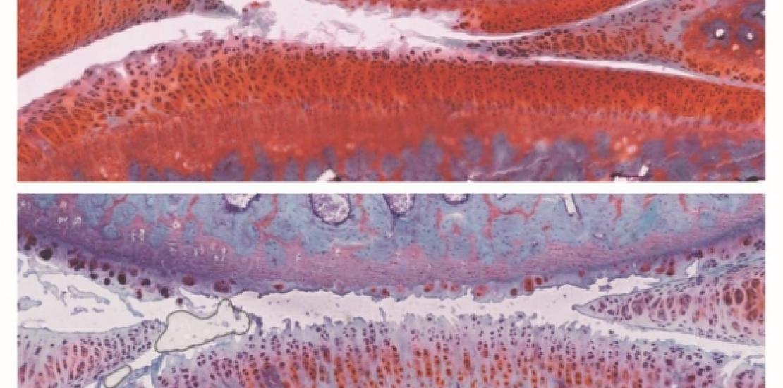 Izpisua logra revertir la artritis mediante la combinación de dos fármacos experimentales