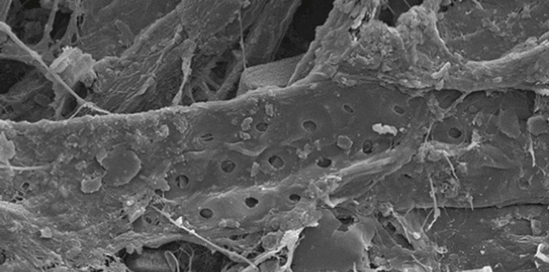 El microscopio electrónico permite avanzar en áreas como la criminología, la alimentación o la ingeniería