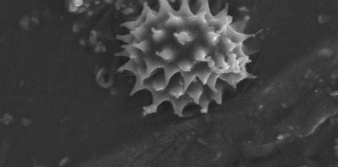 Investigadores de la UCAM hallan evidencias científicas que sitúan al Sudario de Oviedo y la Sábana Santa en el mismo escenario