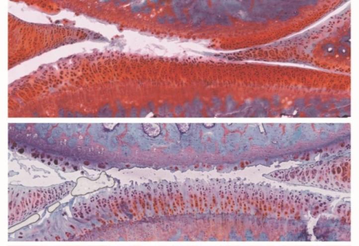 Izpisua logra revertir la artritis mediante la combinación de dos fármacos experimentales