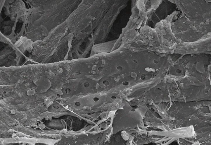 El microscopio electrónico permite avanzar en áreas como la criminología, la alimentación o la ingeniería