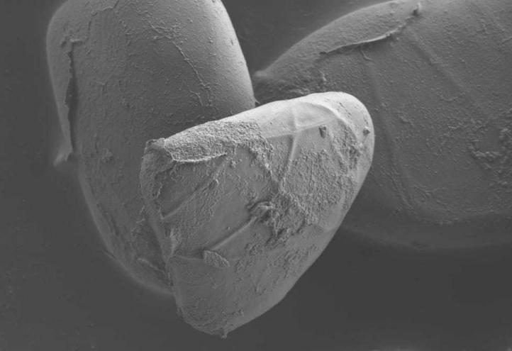 &#039;InvestigArte 2015&#039; expone una imagen capturada con el microscopio electrónico de barrido 