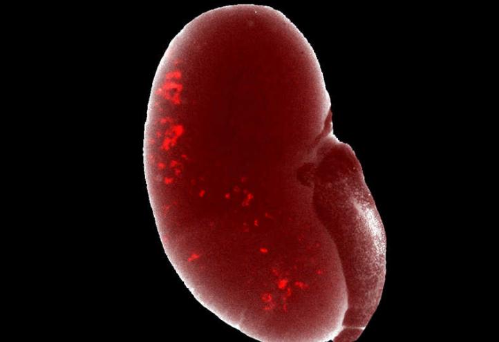 Investigadores  desarrollan un nuevo método  que permite generar  una fuente inagotable de células progenitoras renales humanas
